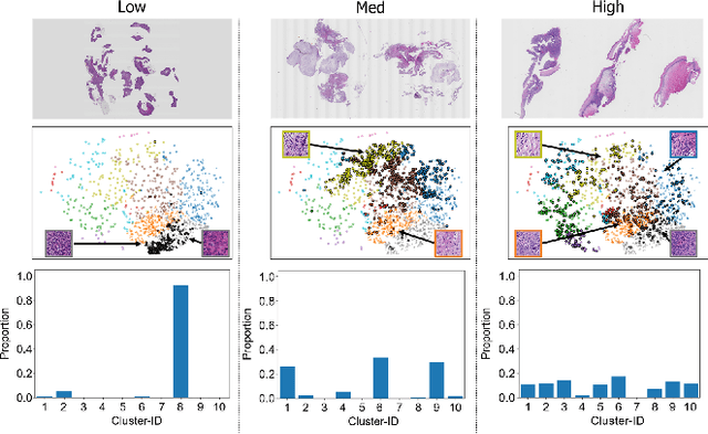 Figure 4 for Cluster Entropy: Active Domain Adaptation in Pathological Image Segmentation