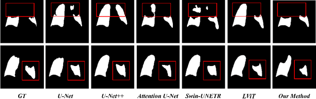 Figure 3 for Ariadne's Thread:Using Text Prompts to Improve Segmentation of Infected Areas from Chest X-ray images