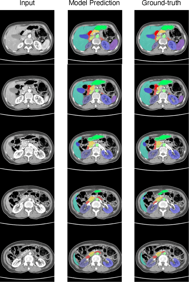 Figure 4 for Large Batch and Patch Size Training for Medical Image Segmentation