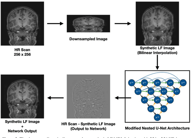 Figure 3 for Synthetic Low-Field MRI Super-Resolution Via Nested U-Net Architecture