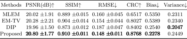 Figure 2 for DULDA: Dual-domain Unsupervised Learned Descent Algorithm for PET image reconstruction