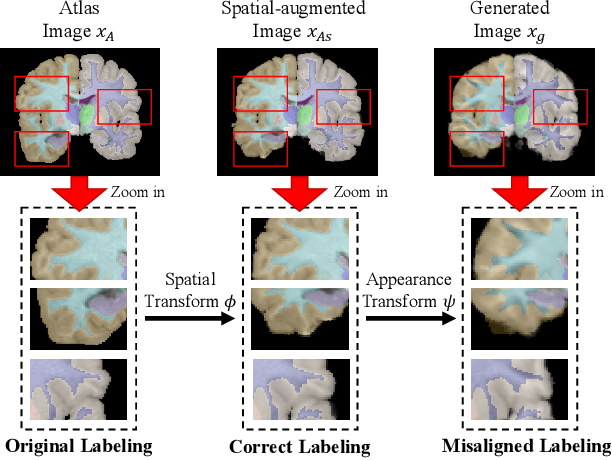 Figure 2 for AdLER: Adversarial Training with Label Error Rectification for One-Shot Medical Image Segmentation