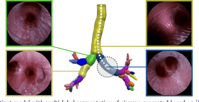 Figure 1 for Airway Label Prediction in Video Bronchoscopy: Capturing Temporal Dependencies Utilizing Anatomical Knowledge