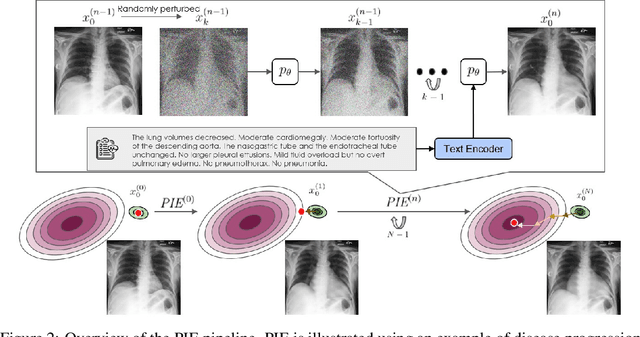 Figure 2 for PIE: Simulating Disease Progression via Progressive Image Editing