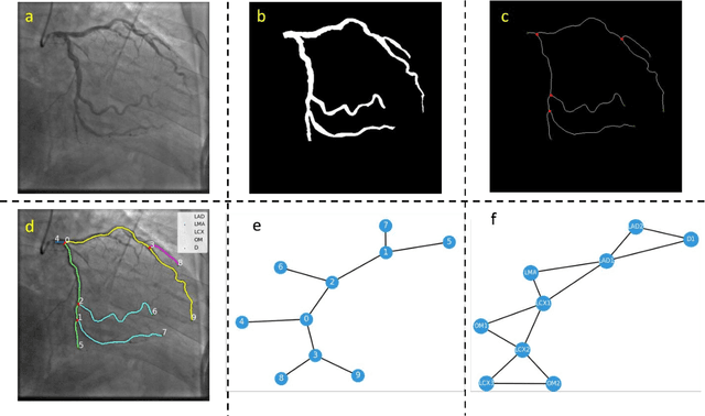 Figure 3 for Coronary Artery Semantic Labeling using Edge Attention Graph Matching Network