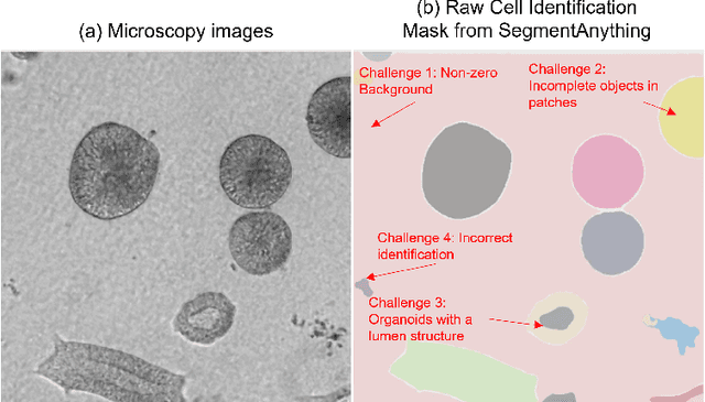 Figure 2 for SegmentAnything helps microscopy images based automatic and quantitative organoid detection and analysis