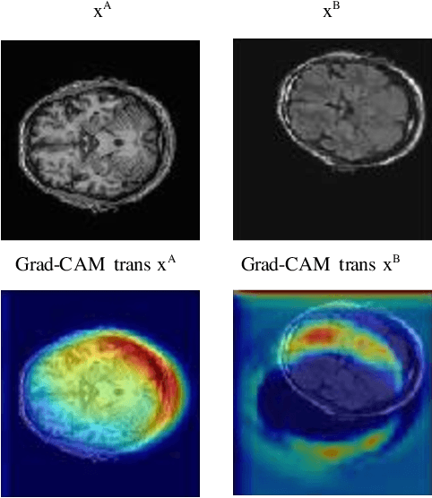 Figure 3 for Explainable unsupervised multi-modal image registration using deep networks