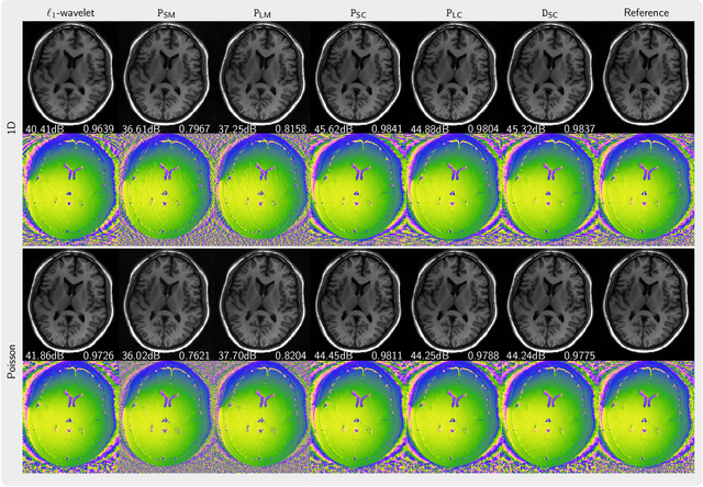 Figure 4 for Generative Image Priors for MRI Reconstruction Trained from Magnitude-Only Images