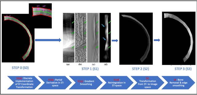 Figure 1 for An Efficient and Robust Method for Chest X-Ray Rib Suppression that Improves Pulmonary Abnormality Diagnosis