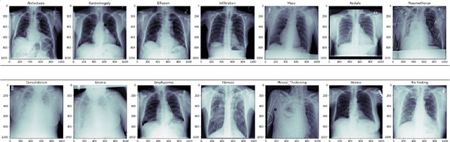 Figure 1 for Auto-outlier Fusion Technique for Chest X-ray classification with Multi-head Attention Mechanism