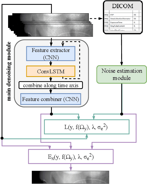 Figure 1 for Self-supervised Physics-based Denoising for Computed Tomography