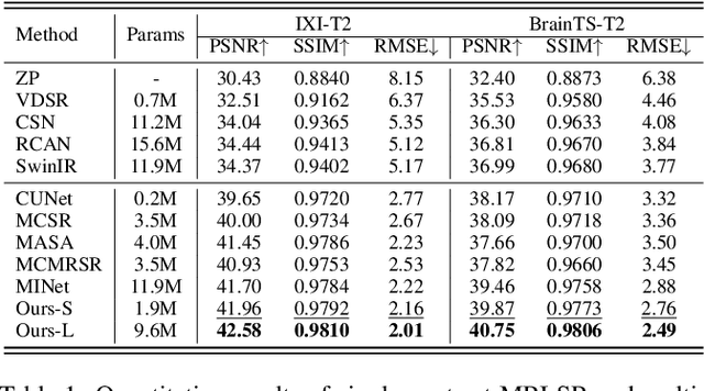 Figure 2 for Deep Unfolding Convolutional Dictionary Model for Multi-Contrast MRI Super-resolution and Reconstruction