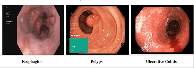 Figure 2 for Gastrointestinal Mucosal Problems Classification with Deep Learning