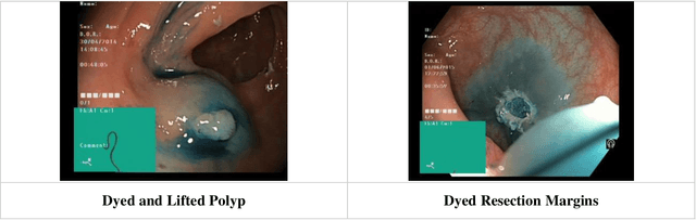 Figure 3 for Gastrointestinal Mucosal Problems Classification with Deep Learning