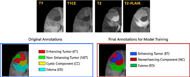 Figure 1 for The Brain Tumor Segmentation (BraTS) Challenge 2023: Focus on Pediatrics (CBTN-CONNECT-DIPGR-ASNR-MICCAI BraTS-PEDs)