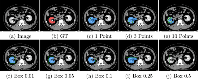 Figure 1 for SAM.MD: Zero-shot medical image segmentation capabilities of the Segment Anything Model