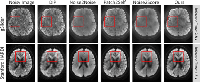 Figure 4 for DDM$^2$: Self-Supervised Diffusion MRI Denoising with Generative Diffusion Models