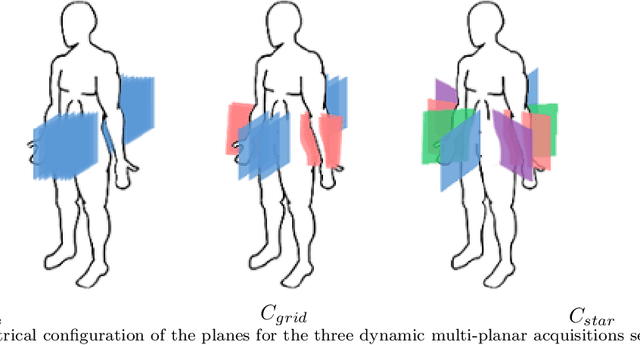 Figure 3 for Three-dimensional reconstruction and characterization of bladder deformations