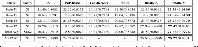 Figure 2 for MRI Recovery with Self-Calibrated Denoisers without Fully-Sampled Data