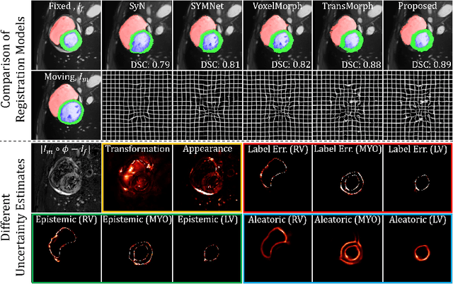 Figure 3 for From Registration Uncertainty to Segmentation Uncertainty