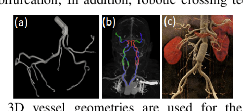 Figure 1 for AI-based Agents for Automated Robotic Endovascular Guidewire Manipulation