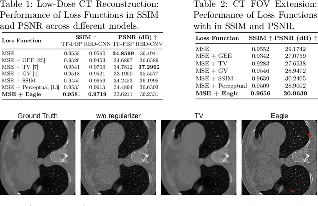 Figure 3 for EAGLE: An Edge-Aware Gradient Localization Enhanced Loss for CT Image Reconstruction