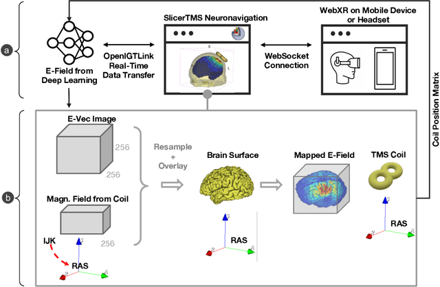 Figure 1 for SlicerTMS: Interactive Real-time Visualization of Transcranial Magnetic Stimulation using Augmented Reality and Deep Learning