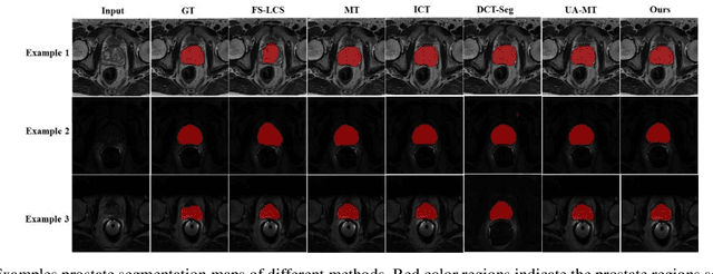 Figure 3 for Semi-Supervised and Self-Supervised Collaborative Learning for Prostate 3D MR Image Segmentation
