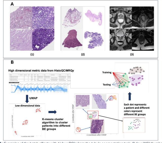 Figure 1 for CohortFinder: an open-source tool for data-driven partitioning of biomedical image cohorts to yield robust machine learning models