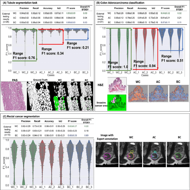 Figure 2 for CohortFinder: an open-source tool for data-driven partitioning of biomedical image cohorts to yield robust machine learning models