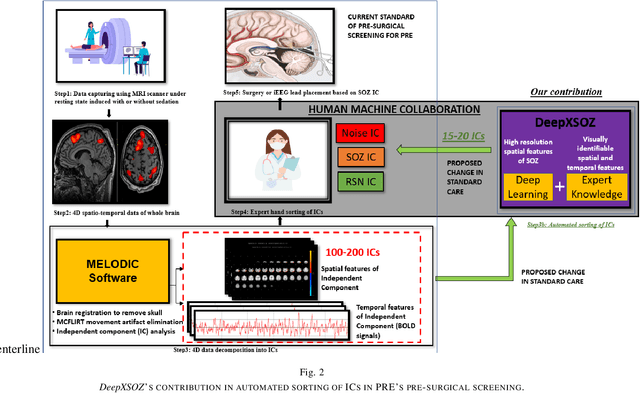 Figure 2 for Merging Deep Learning with Expert Knowledge for Seizure Onset Zone localization from rs-fMRI in Pediatric Pharmaco Resistant Epilepsy