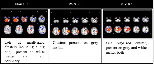 Figure 3 for Merging Deep Learning with Expert Knowledge for Seizure Onset Zone localization from rs-fMRI in Pediatric Pharmaco Resistant Epilepsy