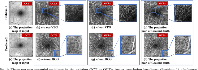 Figure 1 for Vessel-Promoted OCT to OCTA Image Translation by Heuristic Contextual Constraints