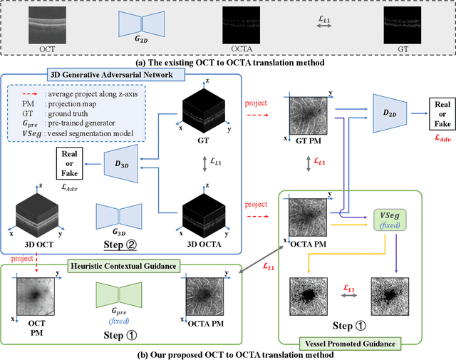 Figure 2 for Vessel-Promoted OCT to OCTA Image Translation by Heuristic Contextual Constraints