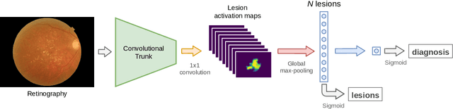 Figure 1 for Weakly-supervised detection of AMD-related lesions in color fundus images using explainable deep learning