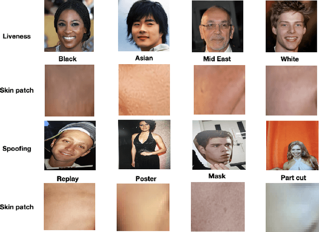 Figure 1 for FaceSkin: A Privacy Preserving Facial skin patch Dataset for multi Attributes classification