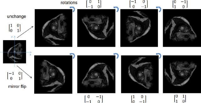 Figure 1 for Prediction of Geometric Transformation on Cardiac MRI via Convolutional Neural Network