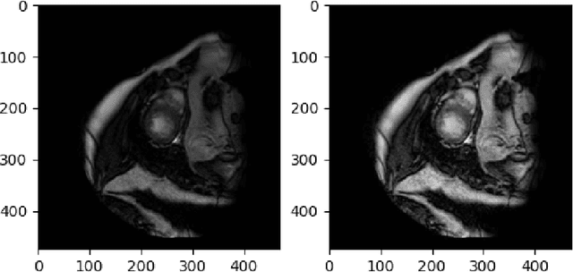 Figure 4 for Prediction of Geometric Transformation on Cardiac MRI via Convolutional Neural Network