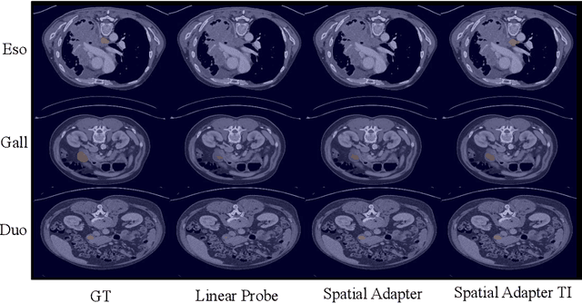 Figure 4 for Transductive few-shot adapters for medical image segmentation