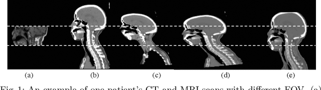 Figure 1 for Matching in the Wild: Learning Anatomical Embeddings for Multi-Modality Images