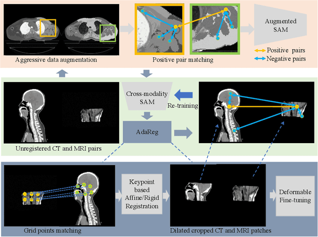 Figure 3 for Matching in the Wild: Learning Anatomical Embeddings for Multi-Modality Images