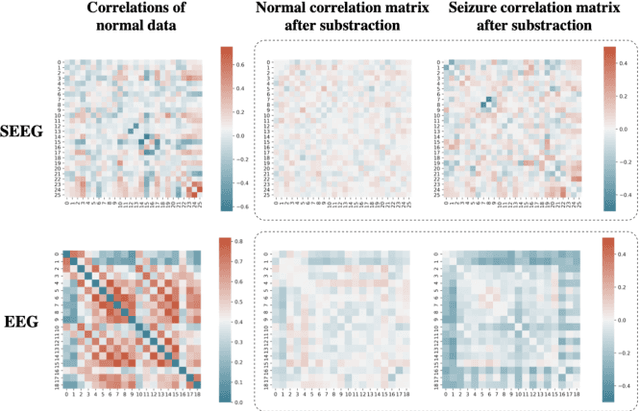 Figure 1 for MBrain: A Multi-channel Self-Supervised Learning Framework for Brain Signals