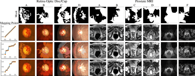 Figure 4 for Domain Generalization with Adversarial Intensity Attack for Medical Image Segmentation