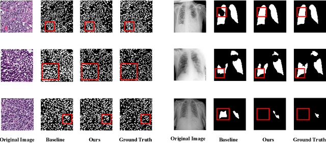 Figure 4 for Multi-dimensional Fusion and Consistency for Semi-supervised Medical Image Segmentation