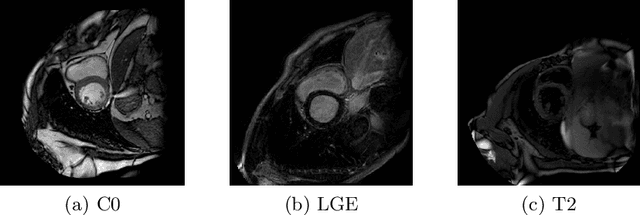 Figure 3 for Recognition of Cardiac MRI Orientation via Deep Neural Networks and a Method to Improve Prediction Accuracy