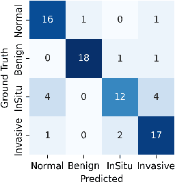 Figure 4 for Digital Histopathology with Graph Neural Networks: Concepts and Explanations for Clinicians