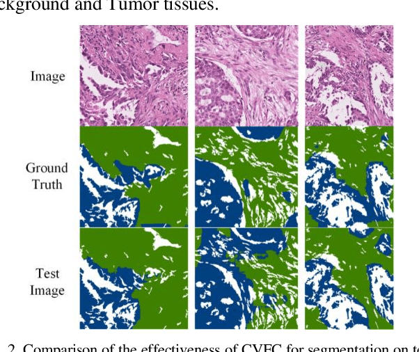 Figure 2 for CVFC: Attention-Based Cross-View Feature Consistency for Weakly Supervised Semantic Segmentation of Pathology Images