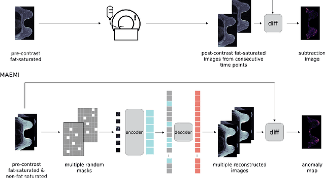 Figure 1 for 3D Masked Autoencoders with Application to Anomaly Detection in Non-Contrast Enhanced Breast MRI