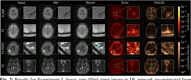 Figure 3 for PixCUE -- Joint Uncertainty Estimation and Image Reconstruction in MRI using Deep Pixel Classification