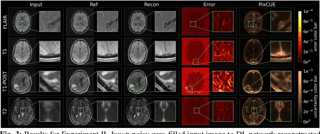 Figure 4 for PixCUE: Joint Uncertainty Estimation and Image Reconstruction in MRI using Deep Pixel Classification